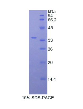 肌球蛋白ⅠF(MYO1F)重组蛋白,Recombinant Myosin IF (MYO1F)