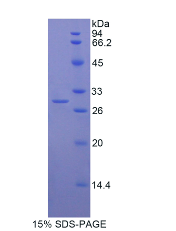 肌球蛋白ⅠG(MYO1G)重组蛋白,Recombinant Myosin IG (MYO1G)