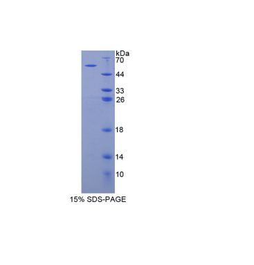 肌球蛋白ⅠC(MYO1C)重组蛋白,Recombinant Myosin IC (MYO1C)