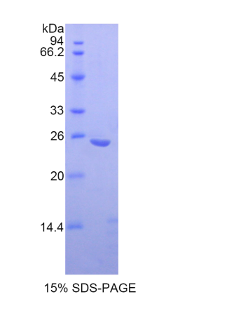 破骨細(xì)胞刺激因子1(OSF)重組蛋白,Recombinant Osteoclast Stimulating Factor 1 (OSF)