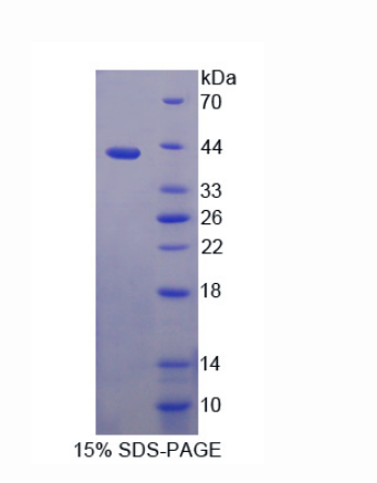 矢車菊苷α2(CENTa2)重組蛋白,Recombinant Centaurin Alpha 2 (CENTa2)