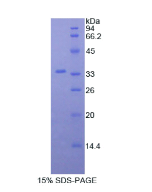 肌球蛋白ⅠD(MYO1D)重組蛋白,Recombinant Myosin ID (MYO1D)