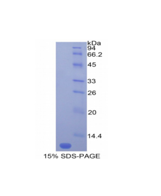 单核细胞趋化蛋白5(MCP5)重组蛋白,Recombinant Monocyte Chemotactic Protein 5 (MCP5)