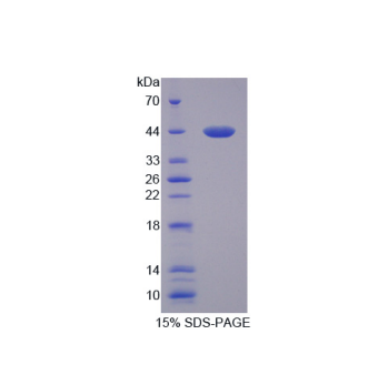 血小板反应蛋白解整合素金属肽酶10(ADAMTS10)重组蛋白,Recombinant A Disintegrin And Metalloproteinase With Thrombospondin 10 (ADAMTS10)