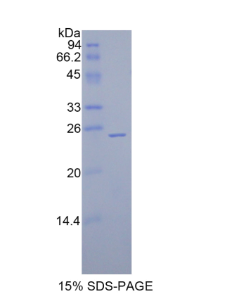 谷胱甘肽过氧化酶5(GPX5)重组蛋白,Recombinant Glutathione Peroxidase 5 (GPX5)