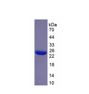 絲束蛋白3(PLS3)重組蛋白,Recombinant Plastin 3 (PLS3)