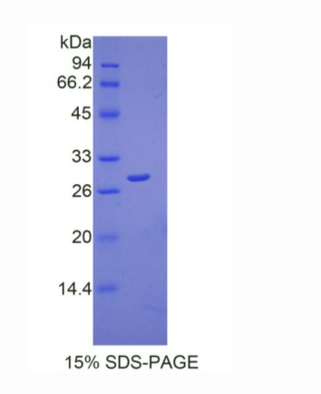 過氧化還原酶3(PRDX3)重組蛋白,Recombinant Peroxiredoxin 3 (PRDX3)