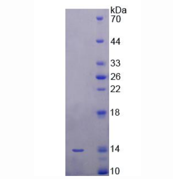 9kDa信號識別顆粒(SRP9)重組蛋白,Recombinant Signal Recognition Particle 9kDa (SRP9)