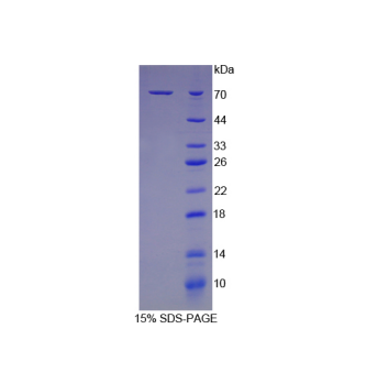 70kDa热休克蛋白1B(HSPA1B)重组蛋白,Recombinant Heat Shock 70kDa Protein 1B (HSPA1B)
