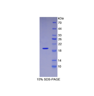 血小板反應(yīng)蛋白解整合素金屬肽酶12(ADAMTS12)重組蛋白,Recombinant A Disintegrin And Metalloproteinase With Thrombospondin 12 (ADAMTS12)