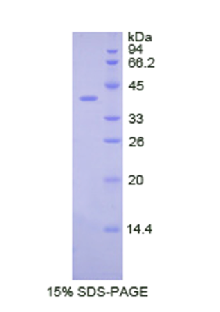 集落刺激因子2受體β(CSF2Rb)重組蛋白,Recombinant Colony Stimulating Factor 2 Receptor Beta (CSF2Rb)