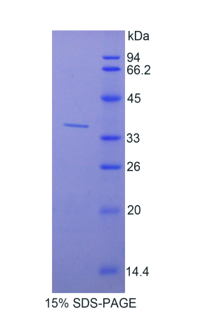 CutC铜转运蛋白(CUTC)重组蛋白,Recombinant CutC Copper Transporter (CUTC)