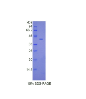 血管緊張素Ⅲ(AngIII)重組蛋白,Recombinant Angiotensin III (AngIII)