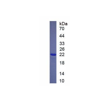 B-细胞淋巴瘤因子2样蛋白2(Bcl2L2)重组蛋白,Recombinant B-Cell CLL/Lymphoma 2 Like Protein 2 (Bcl2L2)