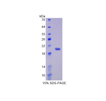 白介素17受体B(IL17RB)重组蛋白,Recombinant Interleukin 17 Receptor B (IL17RB)