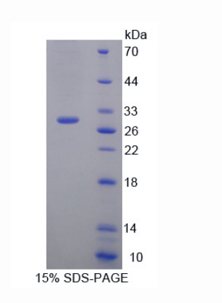 白介素17受體C(IL17RC)重組蛋白,Recombinant Interleukin 17 Receptor C (IL17RC)