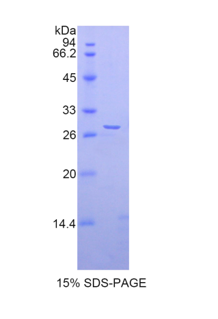 解整合素金属蛋白酶5(ADAM5)重组蛋白,Recombinant A Disintegrin And Metalloprotease 5 (ADAM5)