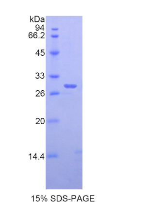 解整合素金屬蛋白酶6(ADAM6)重組蛋白,Recombinant A Disintegrin And Metalloprotease 6 (ADAM6)