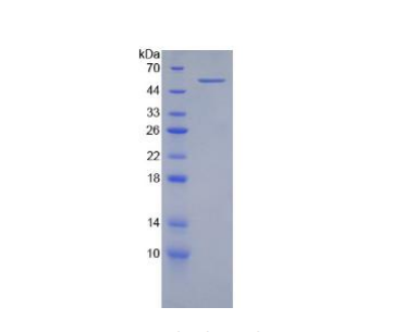 整合素β2(CD18)重组蛋白,Recombinant Integrin Beta 2 (CD18)