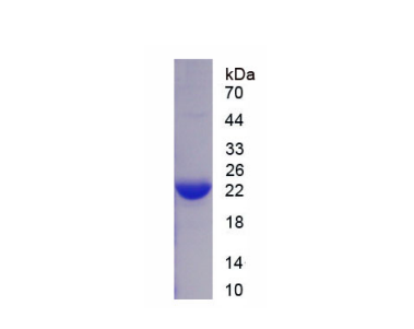 CD247分子(CD247)重组蛋白,Recombinant Cluster Of Differentiation 247 (CD247)