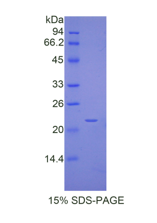 晶狀體蛋白αA(CRYaA)重組蛋白,Recombinant Crystallin Alpha A (CRYaA)