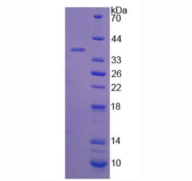 17-β-羟基类固醇脱氢酶12(HSD17b12)重组蛋白,Recombinant 17-Beta-Hydroxysteroid Dehydrogenase Type 12 (HSD17b12)