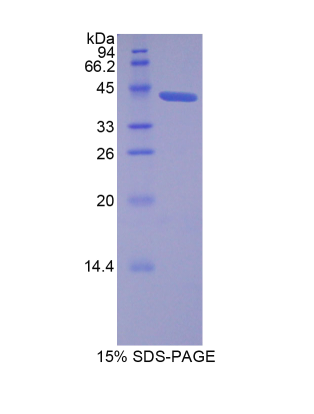 脂质运载蛋白12(LCN12)重组蛋白,Recombinant Lipocalin 12 (LCN12)