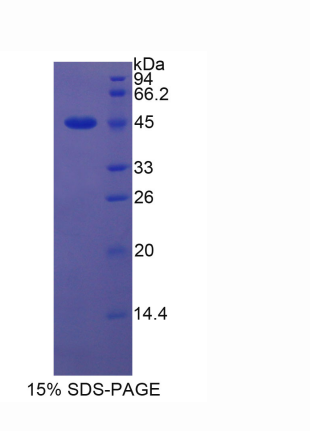 脂质运载蛋白5(LCN5)重组蛋白,Recombinant Lipocalin 5 (LCN5)