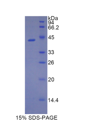 脂质运载蛋白9(LCN9)重组蛋白,Recombinant Lipocalin 9 (LCN9)