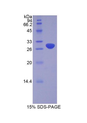 解整合素金屬蛋白酶20(ADAM20)重組蛋白,Recombinant A Disintegrin And Metalloprotease 20 (ADAM20)