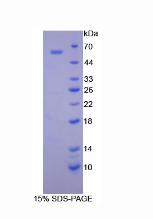 视网膜钙黏附蛋白(RCAD)重组蛋白,Recombinant Cadherin, Retinal (RCAD)