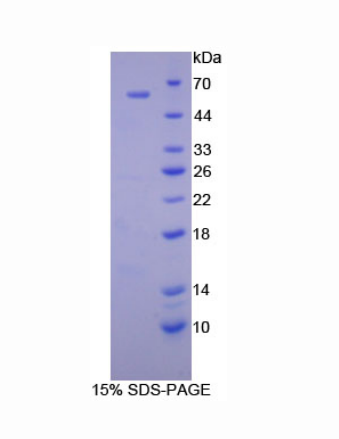 組織蛋白酶A(CTSA)重組蛋白,Recombinant Cathepsin A (CTSA)