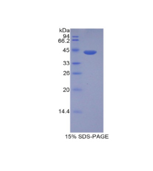 組蛋白1簇H2ad(HIST1H2AD)重組蛋白,Recombinant Histone Cluster 1, H2ad (HIST1H2AD)