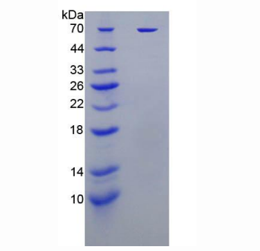 杀伤细胞免疫球蛋白样受体2DL1(KIR2DL1)重组蛋白,Recombinant Killer Cell Immunoglobulin Like Receptor 2DL1 (KIR2DL1)