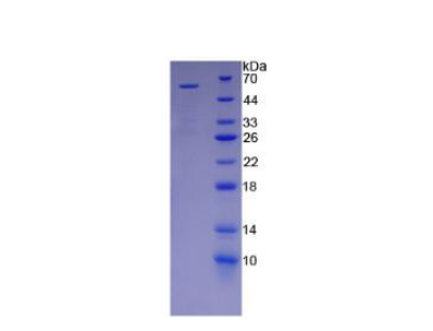 杀伤细胞免疫球蛋白样受体2DS2(KIR2DS2)重组蛋白,Recombinant Killer Cell Immunoglobulin Like Receptor 2DS2 (KIR2DS2)