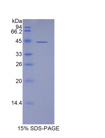 脂质运载蛋白15(LCN15)重组蛋白,Recombinant Lipocalin 15 (LCN15)