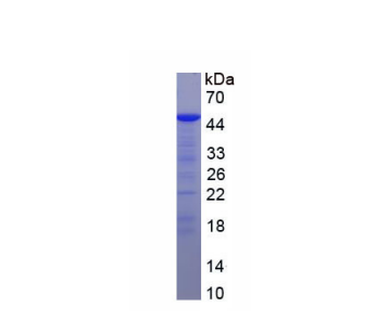 肌球蛋白轻链12B(MYL12B)重组蛋白,Recombinant Myosin Light Chain 12B (MYL12B)