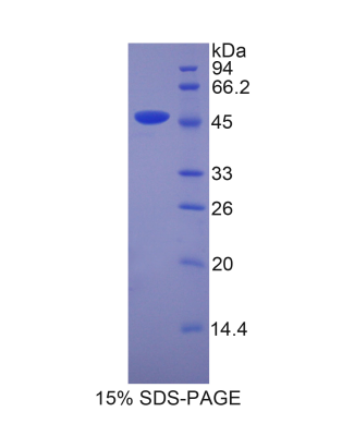 脂质运载蛋白4(LCN4)重组蛋白,Recombinant Lipocalin 4 (LCN4)