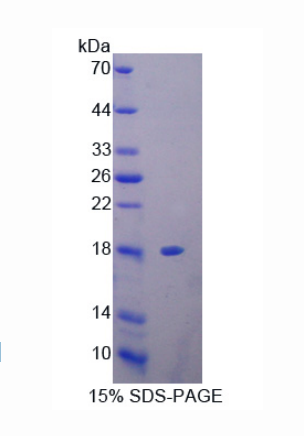 抑絲蛋白3(PFN3)重組蛋白,Recombinant Profilin 3 (PFN3)