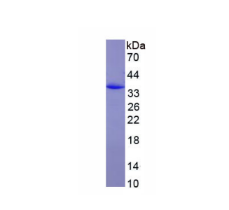 CD163分子(CD163)重組蛋白,Recombinant Cluster Of Differentiation (CD163)