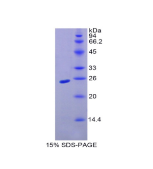 整合素α10(ITGa10)重组蛋白,Recombinant Integrin Alpha 10 (ITGa10)