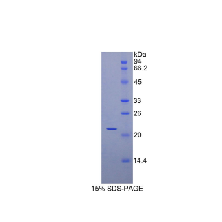 肌球蛋白轻链3(MYL3)重组蛋白,Recombinant Myosin Light Chain 3, Alkali, Ventricular, Slow Skeletal (MYL3)