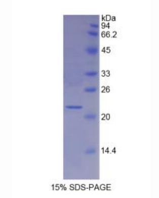 肌球蛋白轻链4(MYL4)重组蛋白,Recombinant Myosin Light Chain 4, Alkali, Atrial, Embryonic (MYL4)