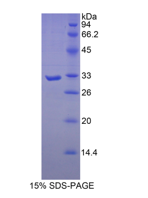 肌球蛋白重鏈16(MYH16)重組蛋白,Recombinant Myosin Heavy Chain 16 (MYH16)