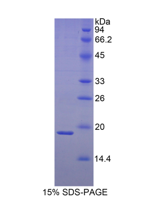 熱休克蛋白β3(HSPb3)重組蛋白,Recombinant Heat Shock Protein Beta 3 (HSPb3)