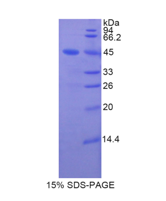 脂质运载蛋白8(LCN8)重组蛋白,Recombinant Lipocalin 8 (LCN8)