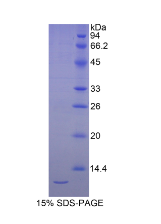 硒蛋白W1(SEPW1)重组蛋白,Recombinant Selenoprotein W1 (SEPW1)