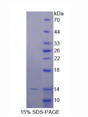 T-激肽原1(KNT1)重组蛋白,Recombinant T-Kininogen 1 (KNT1)