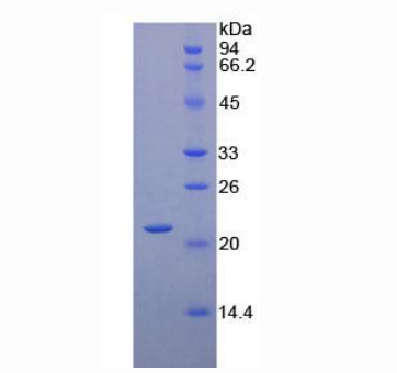 CD8b分子(CD8b)重组蛋白,Recombinant Cluster Of Differentiation 8b (CD8b)