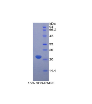 肌球蛋白轻链12A(MYL12A)重组蛋白,Recombinant Myosin Light Chain 12A (MYL12A)